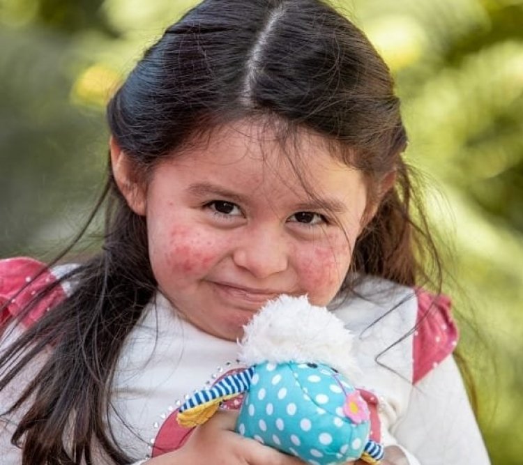 Linares: inaugurarán parque en homenaje a la pequeña Andrea “Lulú” Santos