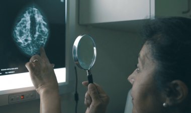 Radiólogo Hernán Valenzuela: cáncer de mama, detectar a tiempo con especialistas es clave