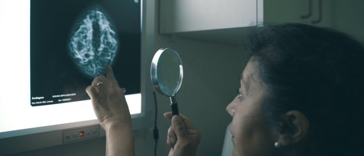 Radiólogo Hernán Valenzuela: cáncer de mama, detectar a tiempo con especialistas es clave
