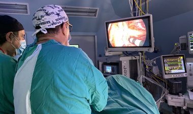 Linares: realizan operaciones de Simpatectomías Videotoracoscópicas en el hospital "Carlos Ibañez"