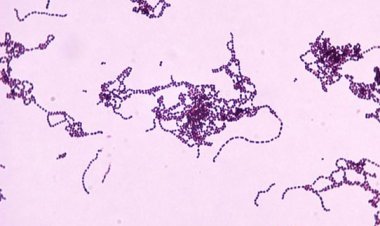 Conoce los efectos y cómo prevenir los contagios de la llamada “bacteria asesina”