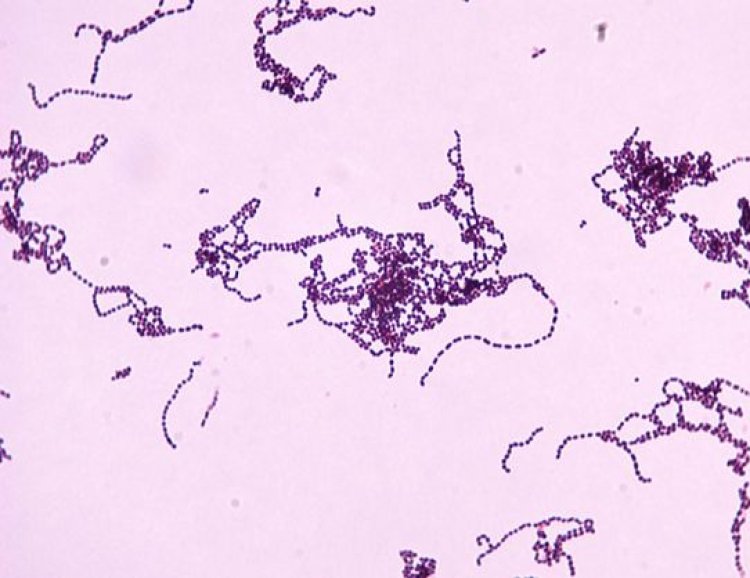 Conoce los efectos y cómo prevenir los contagios de la llamada “bacteria asesina”
