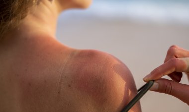 Cuidado con las olas de calor: consejos para evitar la insolación