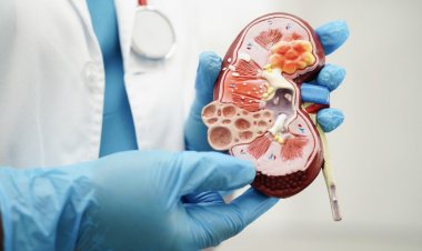 Cáncer de riñón: Advierten incremento de casos por envejecimiento poblacional