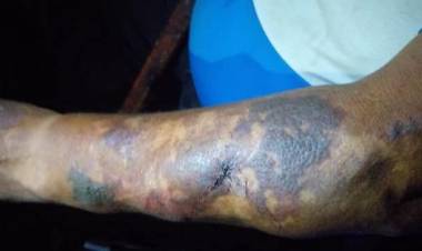 Arrendatarios agreden a adulto mayor en el sector oriente de Linares